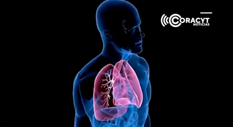 Exhorta especialista a cuidarse para evitar padecer hipertensión pulmonar
