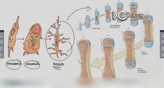 Uno de 10 mil nacimientos presenta osteogénesis imperfecta