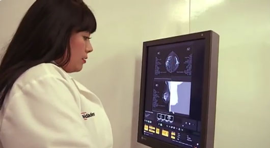 Cáncer de mama y de cuello uterino, los de mayor incidencia en Tlaxcala