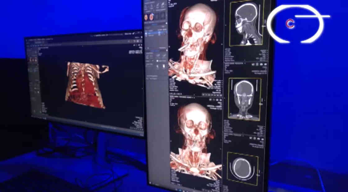 Con nuevo equipamiento y tecnología, el Itaes moderniza sus servicios